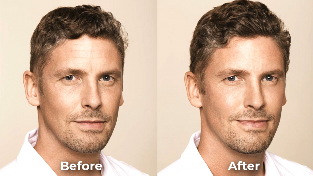 Benefits of Facial Before and After