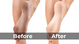 Benefits of Foot Spa, Before and After Result SKILLS Dubai Barbershop