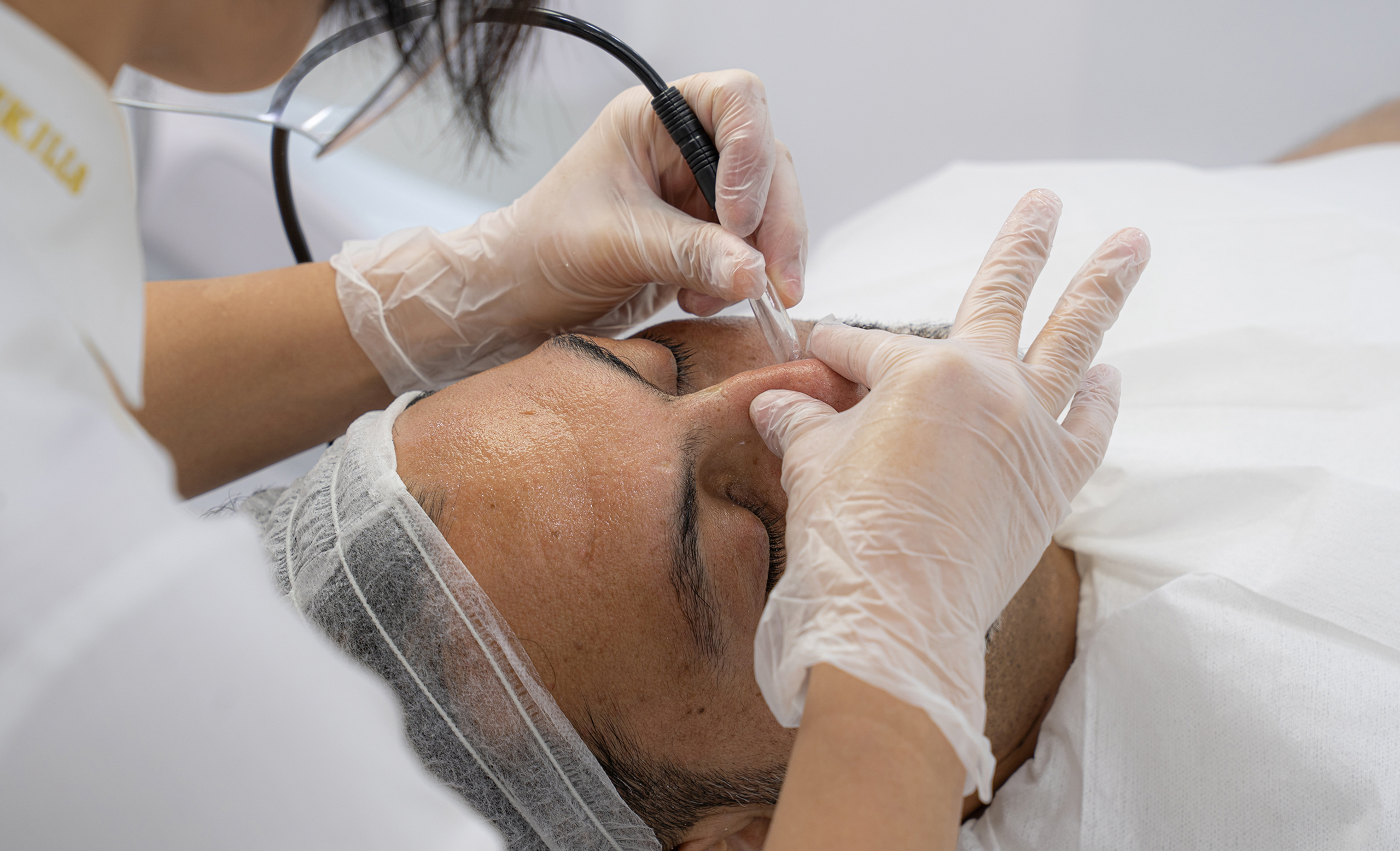 Diamond-Peel-Facial