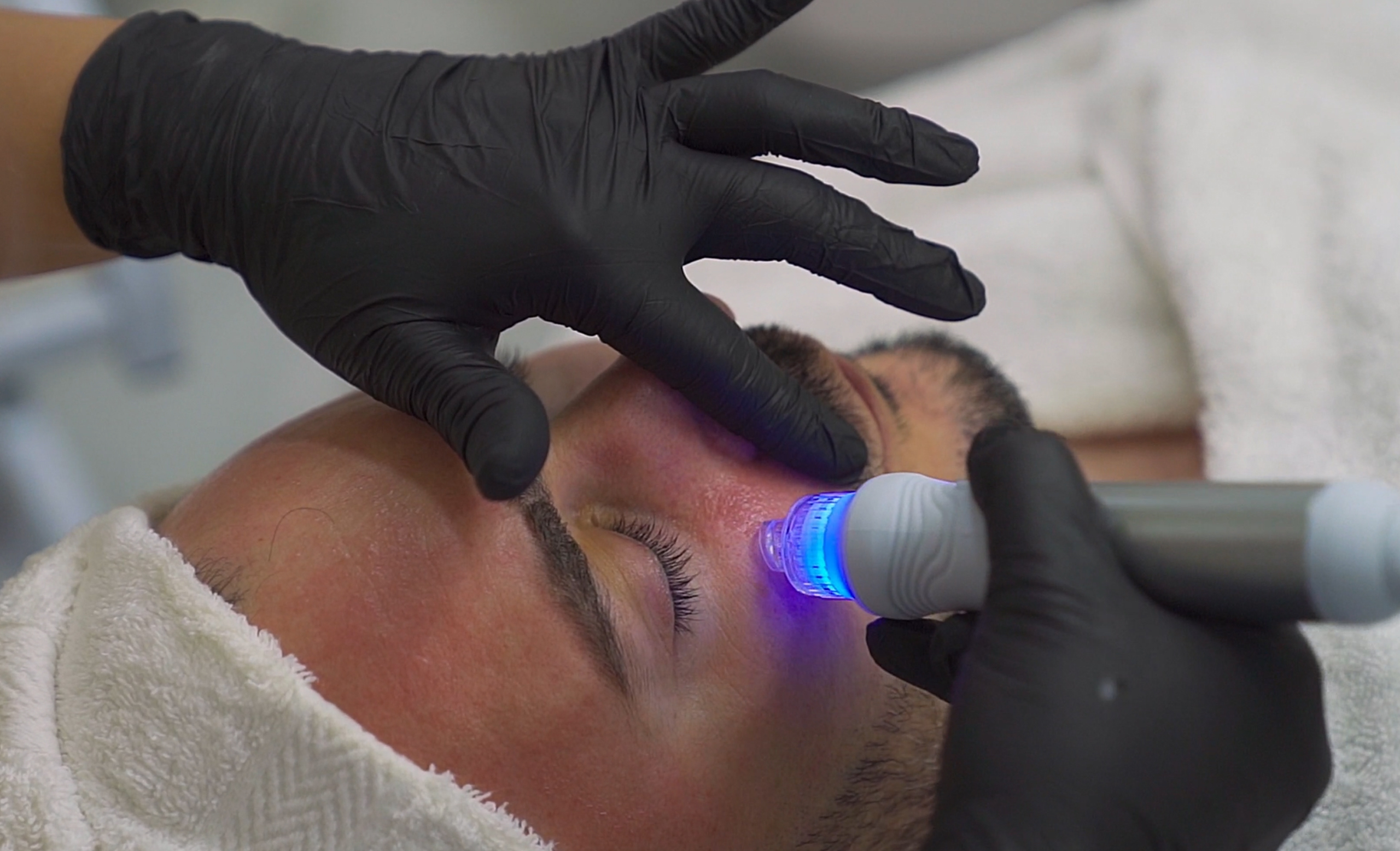 Hydra-Facial-Treatments