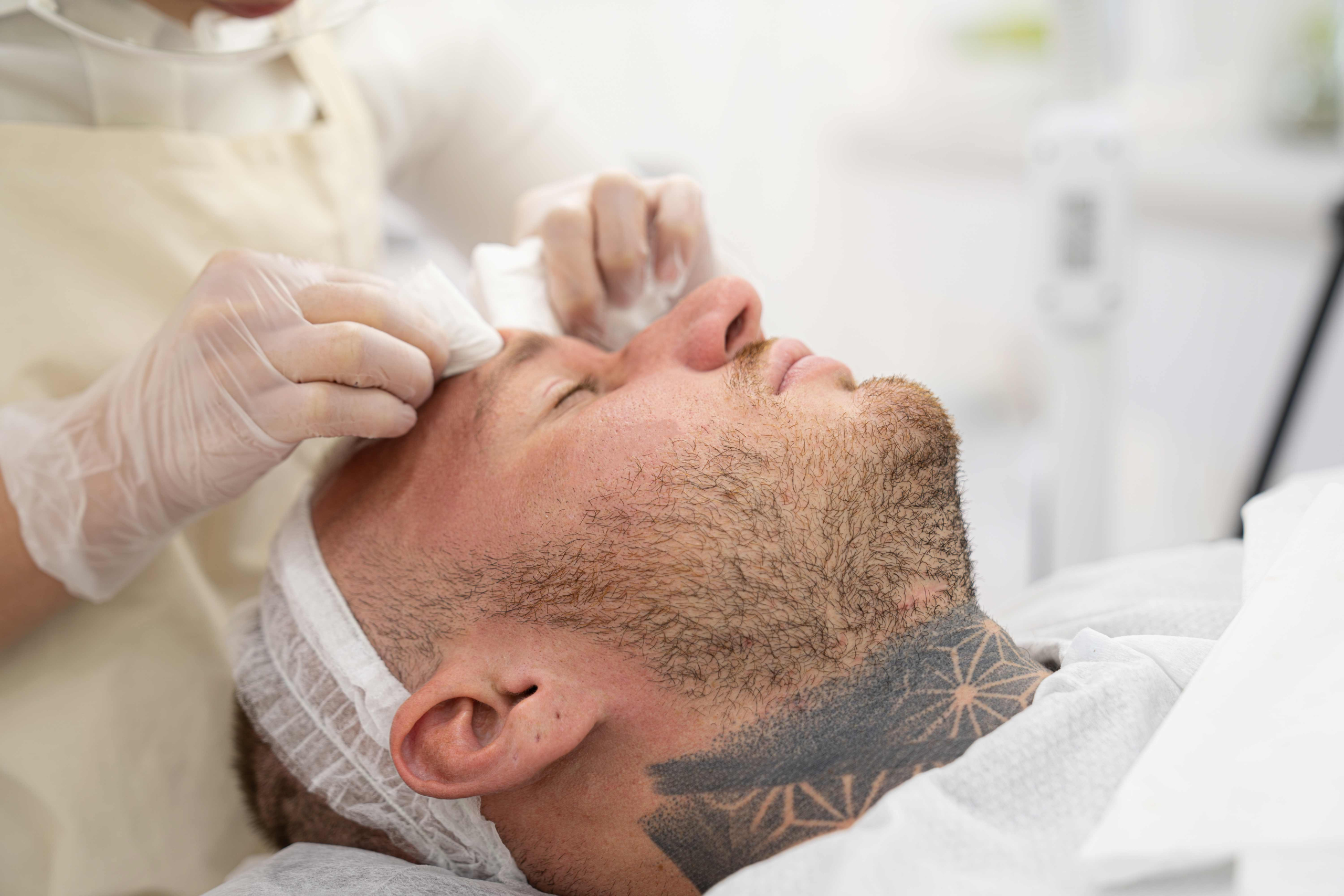 Sun Damage and Men's Skin